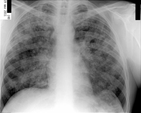 Рентгенография как методы диагностики.