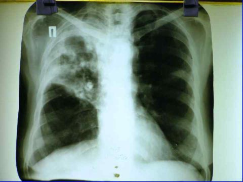 Рентгенологическая методика, как оптимальный метод обследования.