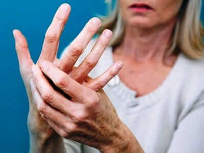 Ревматоидный артрит у женщины