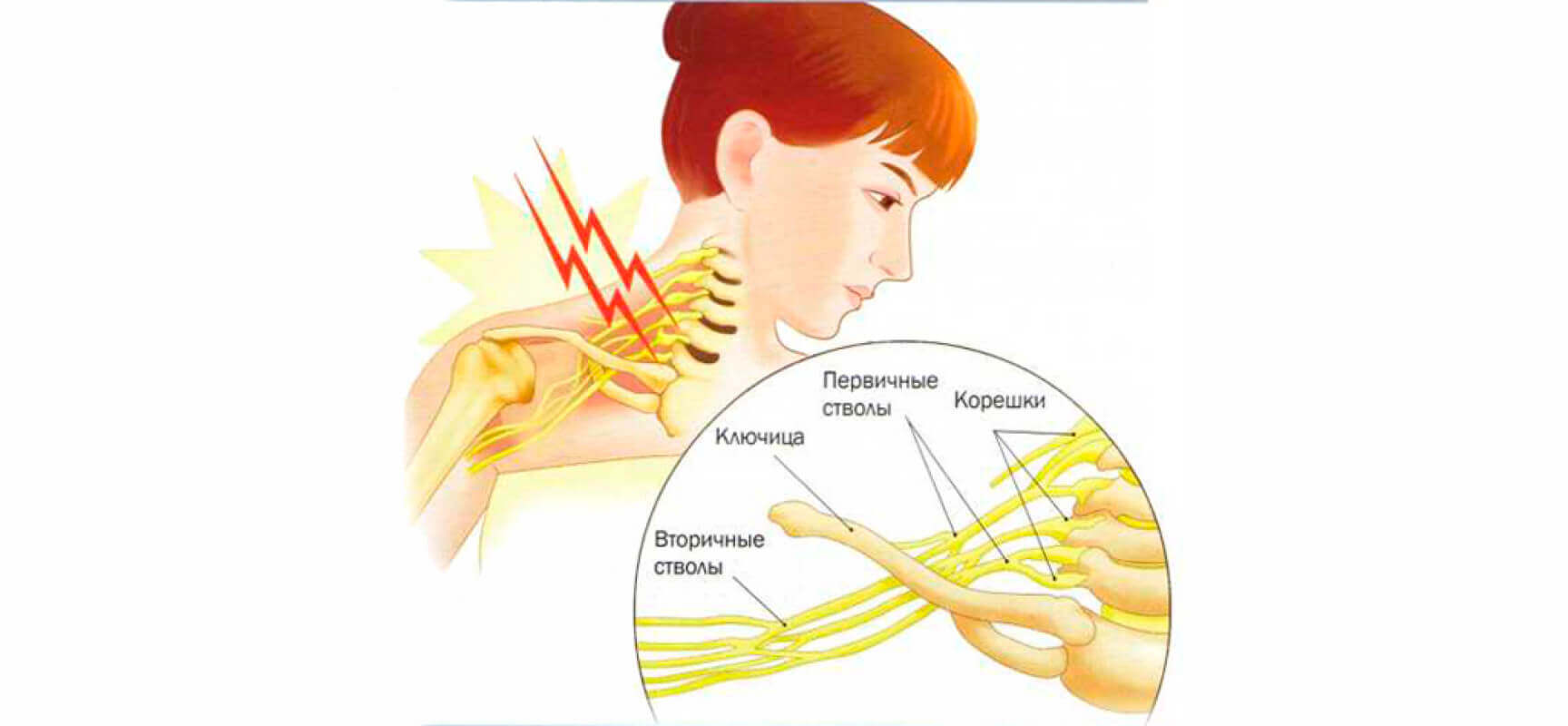 Нервы в плечевом сплетении