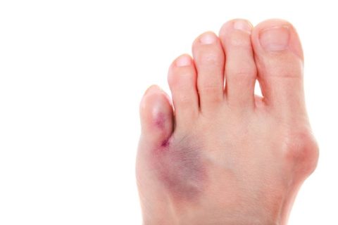 Симптоматические проявления травмированного пальца на ноге
