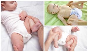 Вывих тазобедренного сустава у младенцев