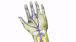 Заболевания суставов пальцев на руках