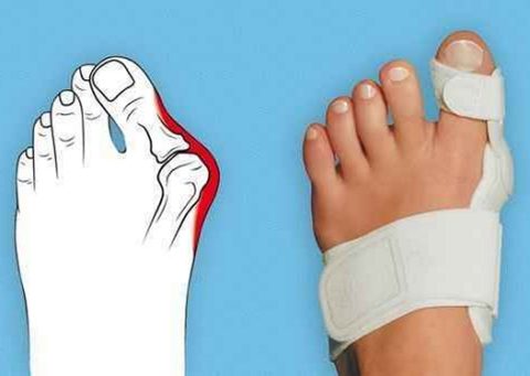 Способы эффективного лечения и восстановления целостности кости пальца на ноге