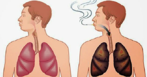 Сравнительное фото дыхательной системы курящего человека и человека без никотиновой зависимости.