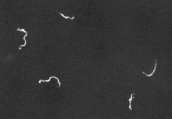 Ложноотрицательный анализ на сифилис темнопольная микроскопия
