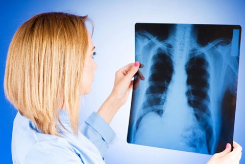 Туберкулез – сложное и опасное заболевание, поэтому важно своевременное проведение обследования