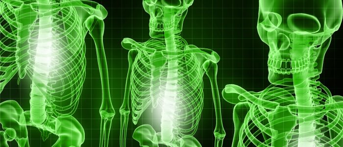 Чем укрепить кости при остеопорозе?