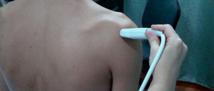 Ультразвуковое исследование плечевого сустава