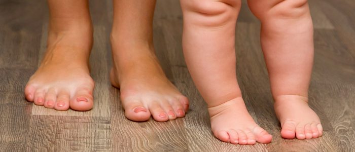 Вальгусная деформация стопы у ребенка